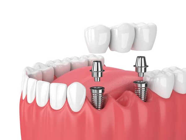 Citymax Dental Clinic