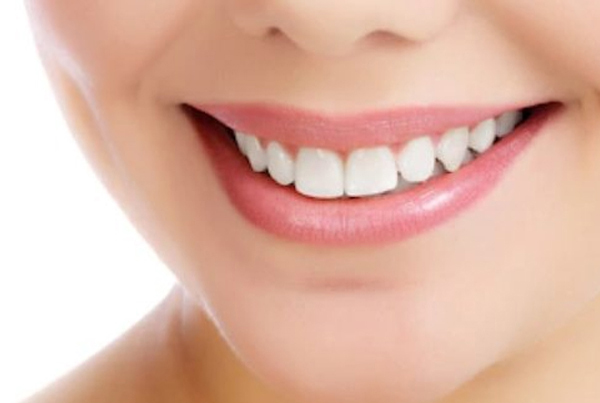 Digital Smile Designing With Veneers