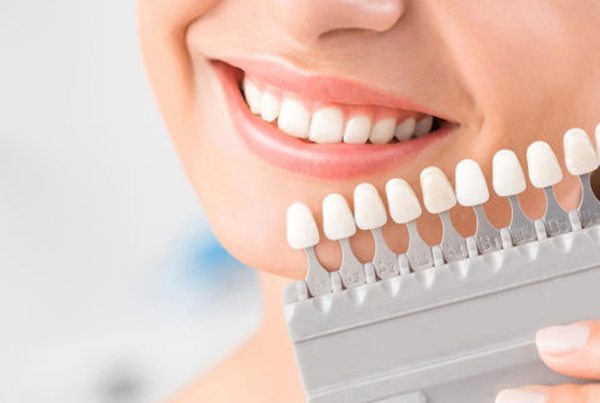 Teeth Whitening